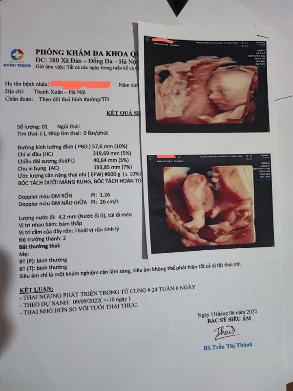 Thông Tin Trên Giấy Khám Thai – Chi Tiết Và Đầy Đủ
