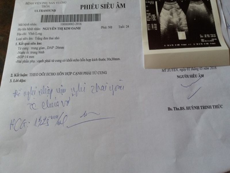 Mẫu giấy khám thai được làm tại Làm Bằng Đại Học